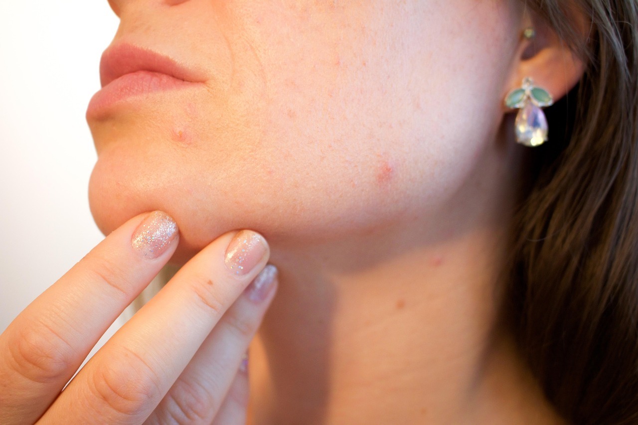 Besplatni dermatološki pregledi